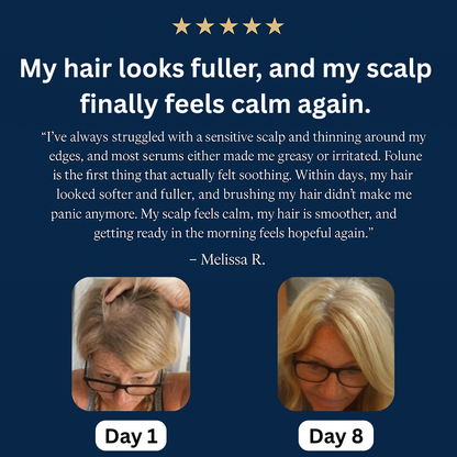 Folune™ Peptide Hair Serum