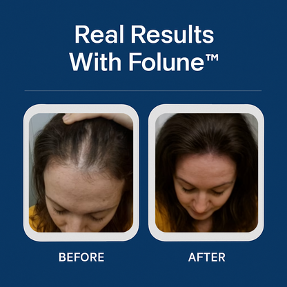 Folune™ Peptide Hair Serum